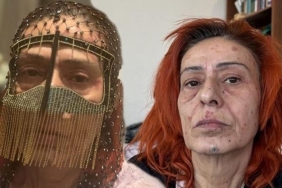 yildiz-tilbenin-yanik-yuzuyle-maskeli-pozu-dikkat-cekti-mBmSdxzn-1024x515